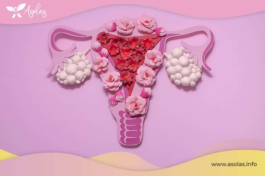 Retraso menstrual por ovarios poliquísticos