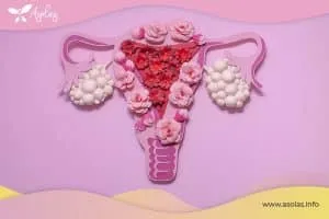 OVARIO POLIQUÍSTICO Y RETRASO MENSTRUAL